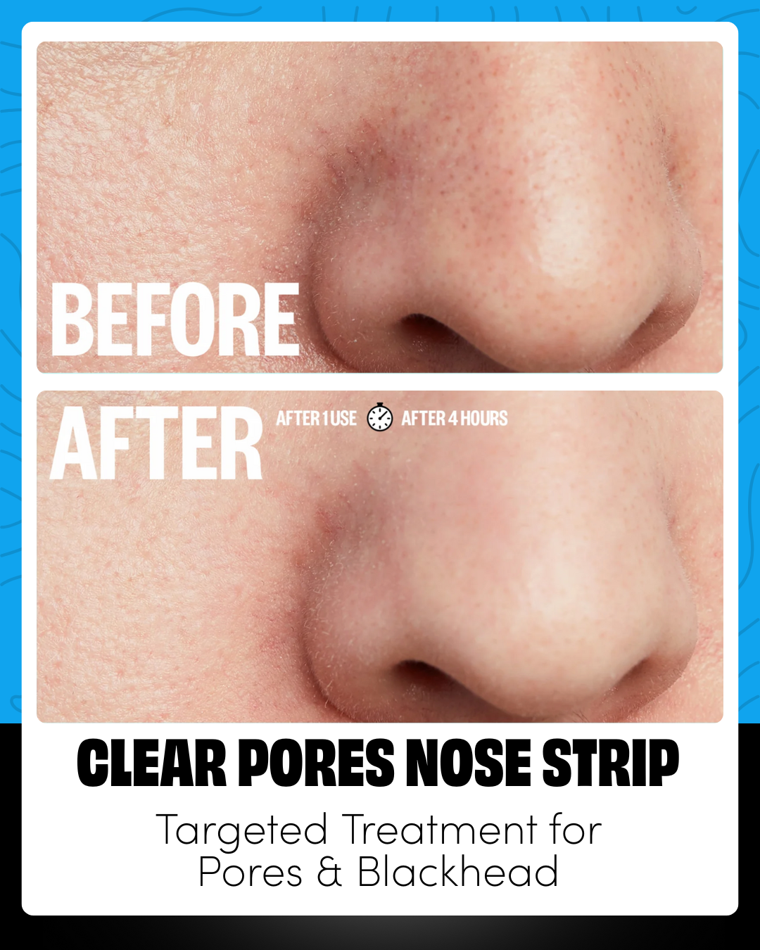 Clear Pores Nose Strip