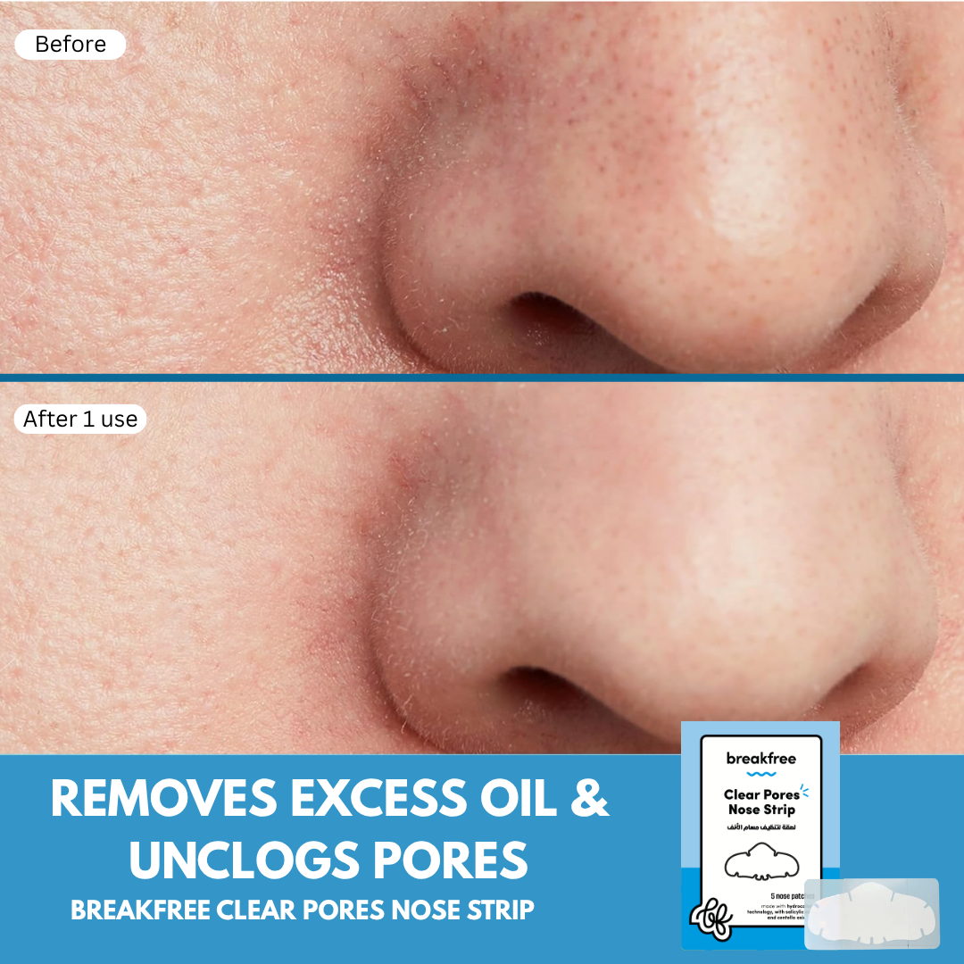Clear Pores Nose Strip