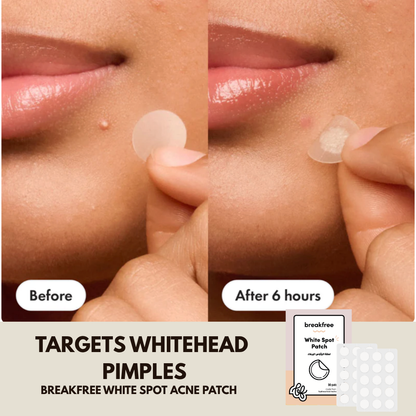 White Spot Patch