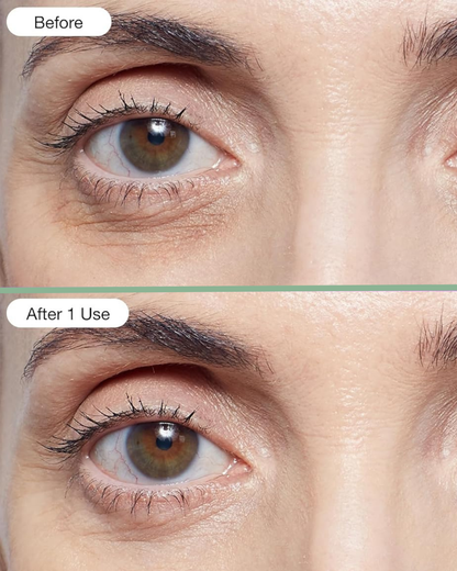 Undereye Hydrogel Patch